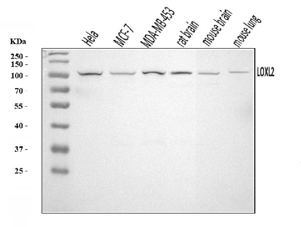 Western blot analysis of LOXL2 using anti-LOXL2 antibody (PB9720).
