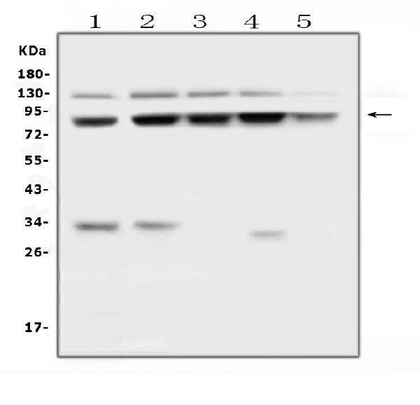 Western blot analysis of MLH1 using anti-MLH1 antibody (PB9724). Electrophoresis was performed on a 5-20% SDS-PAGE gel at 70V (Stacking gel) / 90V (Resolving gel) for 2-3 hours. The sample well of each lane was loaded with 50ug of sample under reducing conditions. Lane 1: human HEK293 whole cell lysates, Lane 2: human Hela whole cell lysates, Lane 3: human COLO-320 whole cell lysates, Lane 4: human T-47D whole cell lysates, Lane 5: human A549 whole cell lysates. After Electrophoresis, proteins were transferred to a Nitrocellulose membrane at 150mA for 50-90 minutes. Blocked the membrane with 5% Non-fat Milk/ TBS for 1.5 hour at RT. The membrane was incubated with rabbit anti-MLH1 antigen affinity purified polyclonal antibody (Catalog # PB9724) at 0.5 μg/mL overnight at 4°C, then washed with TBS-0.1%Tween 3 times with 5 minutes each and probed with a goat anti-rabbit IgG-HRP secondary antibody at a dilution of 1:10000 for 1.5 hour at RT. The signal is developed using an Enhanced Chemiluminescent detection (ECL) kit (Catalog # EK1002) with Tanon 5200 system. A specific band was detected for MLH1 at approximately 85KD. The expected band size for MLH1 is at 85KD.