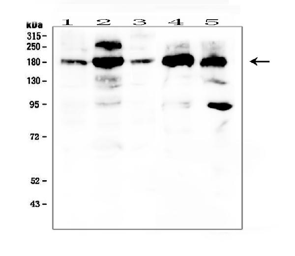 Western blot analysis of PDGFRA using anti-PDGFRA antibody (PB9771). Electrophoresis was performed on a 5-20% SDS-PAGE gel at 70V (Stacking gel) / 90V (Resolving gel) for 2-3 hours. The sample well of each lane was loaded with 50ug of sample under reducing conditions. Lane 1: human HT1080 whole cell lysates, Lane 2: human Caco-2 whole cell lysates, Lane 3: human U20S whole cell lysates, Lane 4: human PC-3 whole cell lysates, Lane 5: human 293T whole cell lysates. After Electrophoresis, proteins were transferred to a Nitrocellulose membrane at 150mA for 50-90 minutes. Blocked the membrane with 5% Non-fat Milk/ TBS for 1.5 hour at RT. The membrane was incubated with rabbit anti-PDGFRA antigen affinity purified polyclonal antibody (Catalog # PB9771) at 0.5 μg/mL overnight at 4°C, then washed with TBS-0.1%Tween 3 times with 5 minutes each and probed with a goat anti-rabbit IgG-HRP secondary antibody at a dilution of 1:10000 for 1.5 hour at RT. The signal is developed using an Enhanced Chemiluminescent detection (ECL) kit (Catalog # EK1002) with Tanon 5200 system. A specific band was detected for PDGFRA at approximately 123KD. The expected band size for PDGFRA is at 180KD.