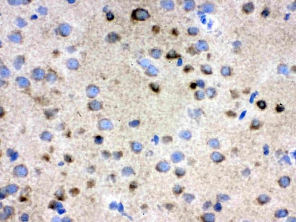 IHC analysis of TCP1 delta using anti-TCP1 delta antibody (PB9927). TCP1 delta was detected in frozen section of rat brain tissue. The tissue section was blocked with 10% goat serum. The tissue section was then incubated with 1μg/ml rabbit anti-TCP1 delta Antibody (PB9927) overnight at 4°C. Biotinylated goat anti-rabbit IgG was used as secondary antibody and incubated for 30 minutes at 37°C. The tissue section was developed using Strepavidin-Biotin-Complex (SABC)(Catalog # SA1022) with DAB as the chromogen.