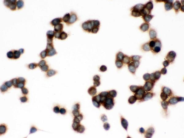 IHC analysis of TCP1 delta using anti-TCP1 delta antibody (PB9927). TCP1 delta was detected in immunocytochemical section of LOVO cell. Enzyme antigen retrieval was performed using IHC enzyme antigen retrieval reagent (AR0022) for 15 mins. The cells were blocked with 10% goat serum. And then incubated with 1μg/ml rabbit anti-TCP1 delta Antibody (PB9927) overnight at 4°C. Biotinylated goat anti-rabbit IgG was used as secondary antibody and incubated for 30 minutes at 37°C. The section was developed using Strepavidin-Biotin-Complex (SABC)(Catalog # SA1022) with DAB as the chromogen.