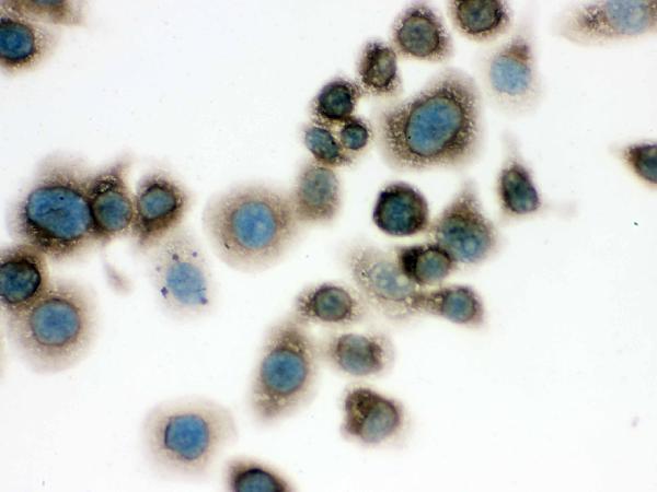 IHC analysis of TCP1 delta using anti-TCP1 delta antibody (PB9927). TCP1 delta was detected in immunocytochemical section of Neuro-2a cell. Enzyme antigen retrieval was performed using IHC enzyme antigen retrieval reagent (AR0022) for 15 mins. The cells were blocked with 10% goat serum. And then incubated with 1μg/ml rabbit anti-TCP1 delta Antibody (PB9927) overnight at 4°C. Biotinylated goat anti-rabbit IgG was used as secondary antibody and incubated for 30 minutes at 37°C. The section was developed using Strepavidin-Biotin-Complex (SABC)(Catalog # SA1022) with DAB as the chromogen.