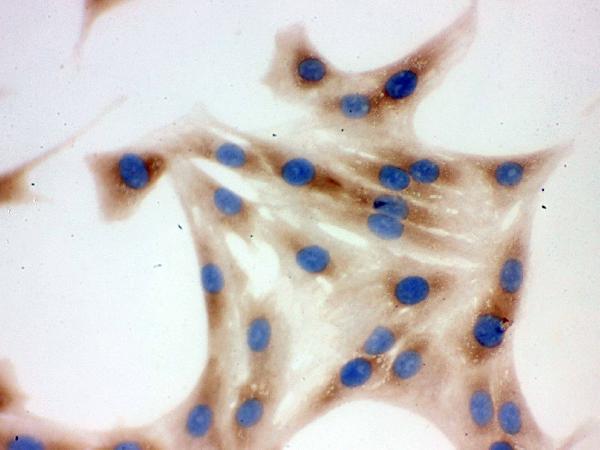 IHC analysis of TCP1 delta using anti-TCP1 delta antibody (PB9927). TCP1 delta was detected in immunocytochemical section of NRK cell. Enzyme antigen retrieval was performed using IHC enzyme antigen retrieval reagent (AR0022) for 15 mins. The cells were blocked with 10% goat serum. And then incubated with 1μg/ml rabbit anti-TCP1 delta Antibody (PB9927) overnight at 4°C. Biotinylated goat anti-rabbit IgG was used as secondary antibody and incubated for 30 minutes at 37°C. The section was developed using Strepavidin-Biotin-Complex (SABC)(Catalog # SA1022) with DAB as the chromogen.