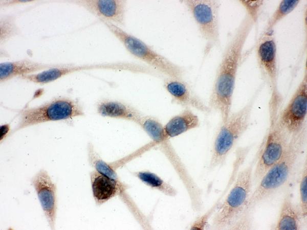 IHC analysis of TCP1 delta using anti-TCP1 delta antibody (PB9927). TCP1 delta was detected in immunocytochemical section of SHG-44 cell. Enzyme antigen retrieval was performed using IHC enzyme antigen retrieval reagent (AR0022) for 15 mins. The cells were blocked with 10% goat serum. And then incubated with 1μg/ml rabbit anti-TCP1 delta Antibody (PB9927) overnight at 4°C. Biotinylated goat anti-rabbit IgG was used as secondary antibody and incubated for 30 minutes at 37°C. The section was developed using Strepavidin-Biotin-Complex (SABC)(Catalog # SA1022) with DAB as the chromogen.