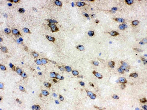 IHC analysis of TCP1 delta using anti-TCP1 delta antibody (PB9927). TCP1 delta was detected in frozen section of mouse brain tissue. The tissue section was blocked with 10% goat serum. The tissue section was then incubated with 1μg/ml rabbit anti-TCP1 delta Antibody (PB9927) overnight at 4°C. Biotinylated goat anti-rabbit IgG was used as secondary antibody and incubated for 30 minutes at 37°C. The tissue section was developed using Strepavidin-Biotin-Complex (SABC)(Catalog # SA1022) with DAB as the chromogen.