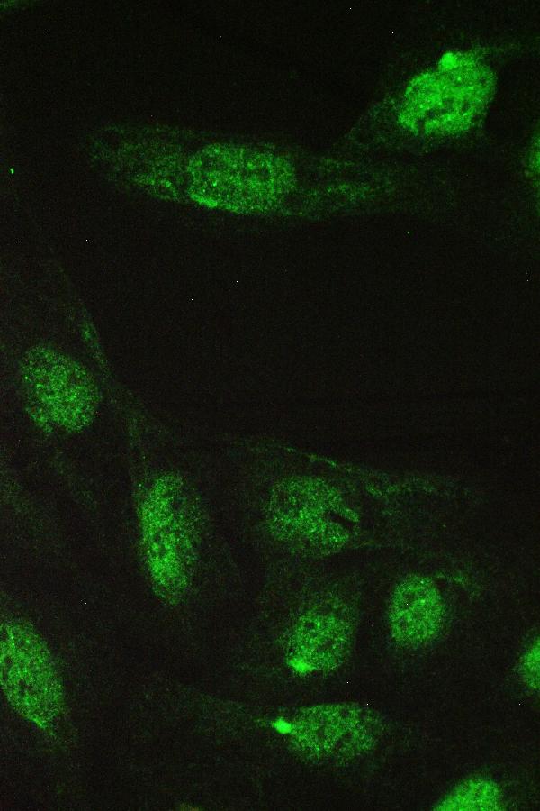 IF analysis of CCT5 using anti-CCT5 antibody (PB9928). CCT5 was detected in immunocytochemical section of U20S cell. Enzyme antigen retrieval was performed using IHC enzyme antigen retrieval reagent (AR0022) for 15 mins. The cells were blocked with 10% goat serum. And then incubated with 2μg/mL rabbit anti-CCT5 Antibody (PB9928) overnight at 4°C. DyLight®488 Conjugated Goat Anti-Rabbit IgG (BA1127) was used as secondary antibody at 1:100 dilution and incubated for 30 minutes at 37°C. Visualize using a fluorescence microscope and filter sets appropriate for the label used.