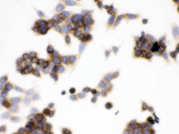 IHC analysis of TCP1 epsilon using anti-TCP1 epsilon antibody (PB9928). TCP1 epsilon was detected in immunocytochemical section of LOVO cell. Enzyme antigen retrieval was performed using IHC enzyme antigen retrieval reagent (AR0022) for 15 mins. The cells were blocked with 10% goat serum. And then incubated with 1μg/ml rabbit anti-TCP1 epsilon Antibody (PB9928) overnight at 4°C. Biotinylated goat anti-rabbit IgG was used as secondary antibody and incubated for 30 minutes at 37°C. The section was developed using Strepavidin-Biotin-Complex (SABC)(Catalog # SA1022) with DAB as the chromogen.