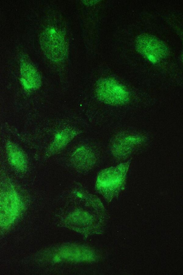 IF analysis of CCT2 using anti-CCT2 antibody (PB9992). CCT2 was detected in immunocytochemical section of U20S cell. Enzyme antigen retrieval was performed using IHC enzyme antigen retrieval reagent (AR0022) for 15 mins. The cells were blocked with 10% goat serum. And then incubated with 2μg/mL rabbit anti-CCT2 Antibody (PB9992) overnight at 4°C. DyLight®488 Conjugated Goat Anti-Rabbit IgG (BA1127) was used as secondary antibody at 1:100 dilution and incubated for 30 minutes at 37°C. Visualize using a fluorescence microscope and filter sets appropriate for the label used.