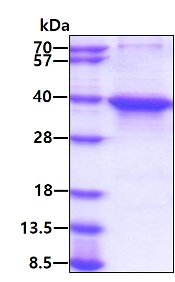 Human Musashi-2 Recombinant Protein