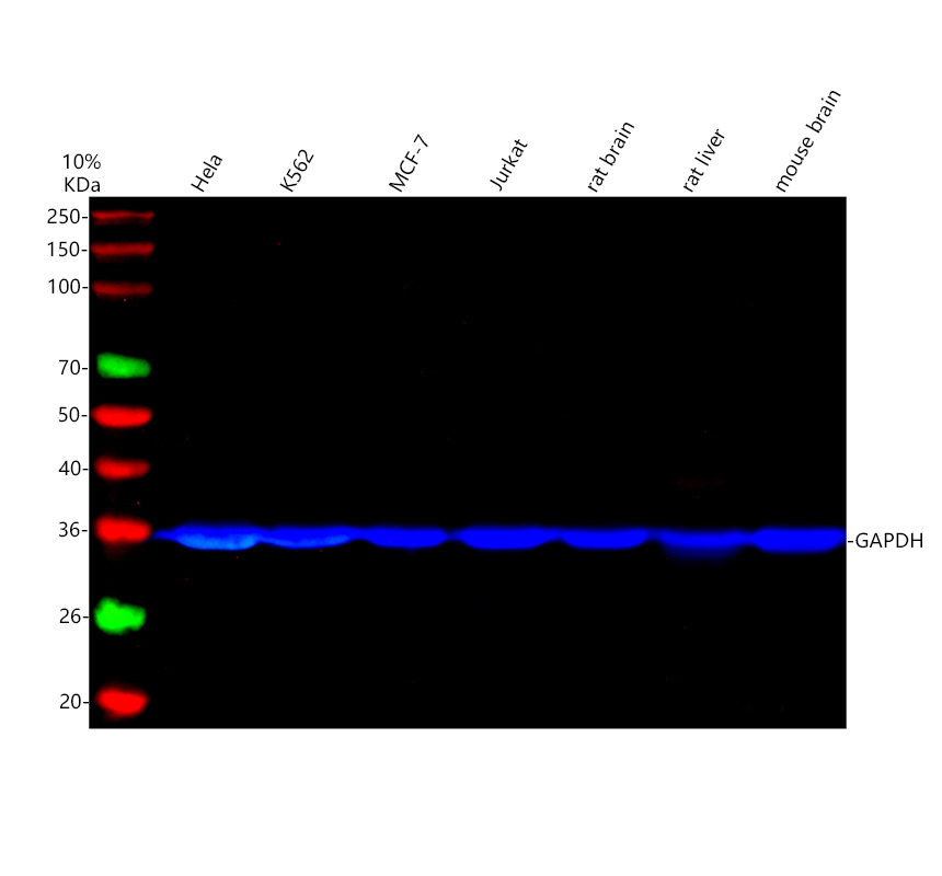 Western blot loading control bands detected by GAPDH antibody